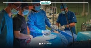 ليبيا.. أطباء مصريون يجرون 11 عملية قلب مفتوح لأطفال في بنغازي