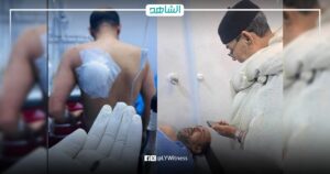 جاءته رصاصة من الظهر.. إصابة مسؤول ليبي حاول تهدئة اشتباكات رأس اجدير