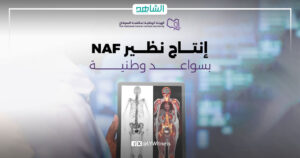 المستشفى الجامعي بطرابلس تنجح في إنتاج مادة تستخدم لتشخيص أورام العظام